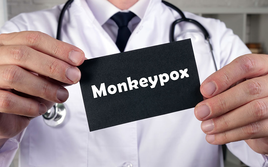 What You Need to Know About Monkeypox