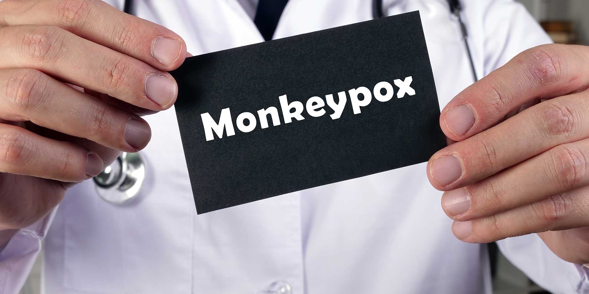 Medical concept about Monkeypox