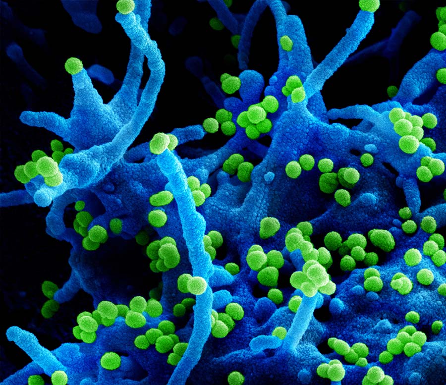 Scanning electron micrograph of Lassa virus budding off a cell. Credit: NIAID