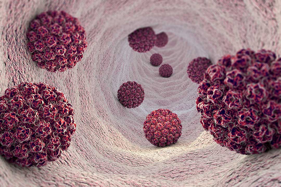 HPV infection is caused by human papillomavirus, a DNA virus, 3D rendering