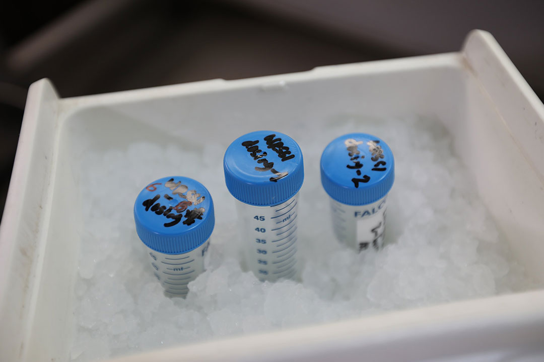 Researchers are working to advance a vaccine against Shigella. Here, one of the candidates is being prepped for use in a clinical study. Photo: PATH.