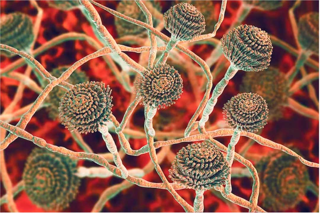The fungus Aspergillus fumigatus. This fungus can cause a number of disorders in people with compromised immune function or other lung diseases. Credit: Kateryna Kon/Science Photo Library/GettyImages