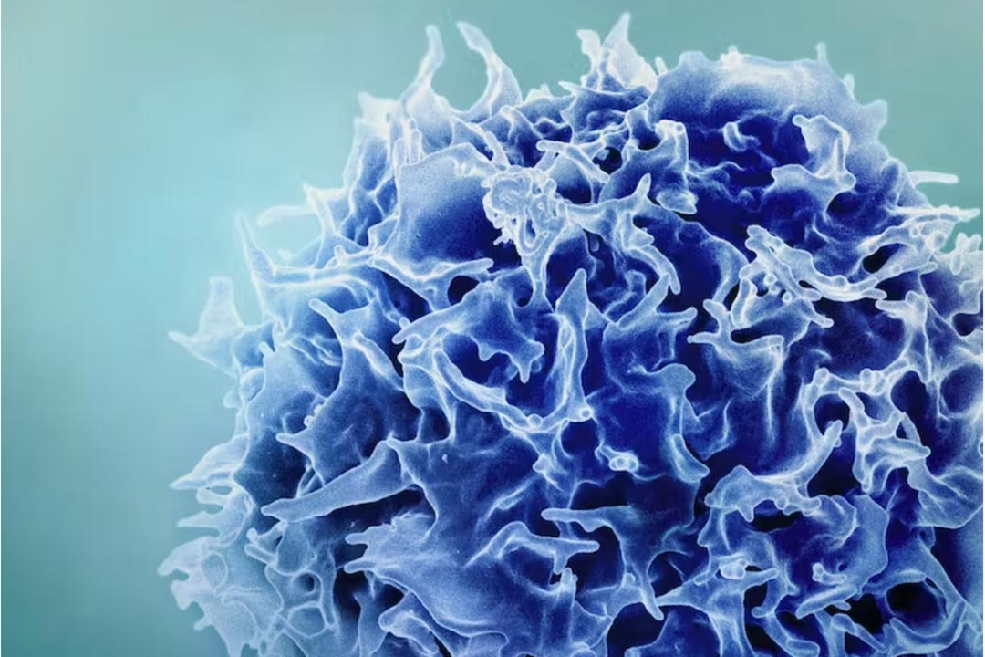 When immune cells become overactive, your immune system itself can cause disease. Credit: NIAID/Flickr, CC BY-SA
