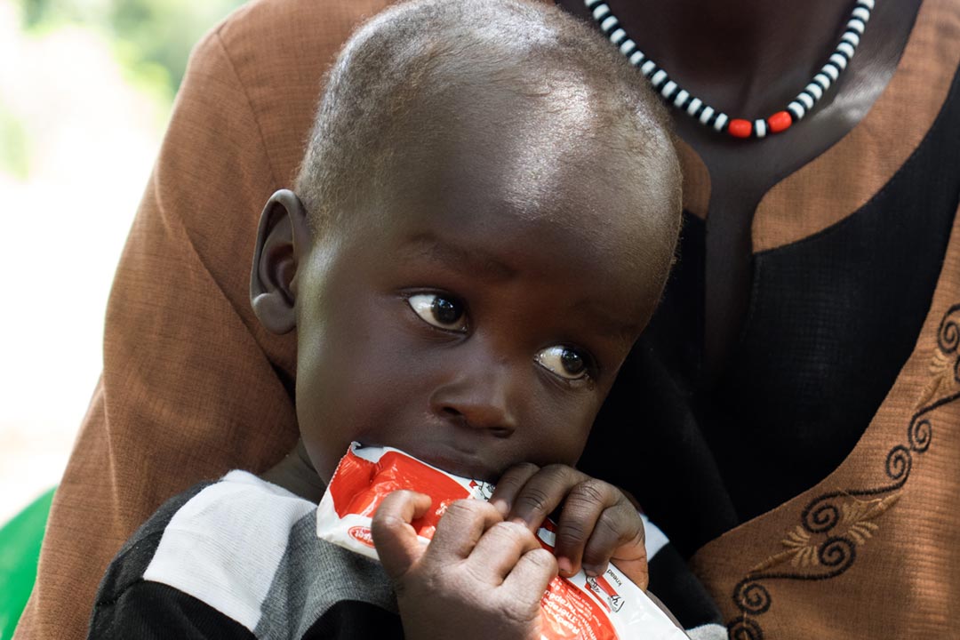 Dang Moses was treated under the Unicef supported emergency nutrition program founded by ECHO. Credit: © UNICEF/UNI202541/Sibiloni