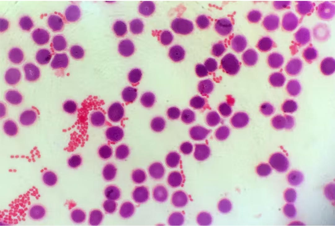 bacteria-and-bloodcells-Scharvik-iStock-Getty-Images-Plus_h1.jpg bacteria-and-bloodcells-Scharvik-iStock-Getty-Images-Plus_h1.jpg