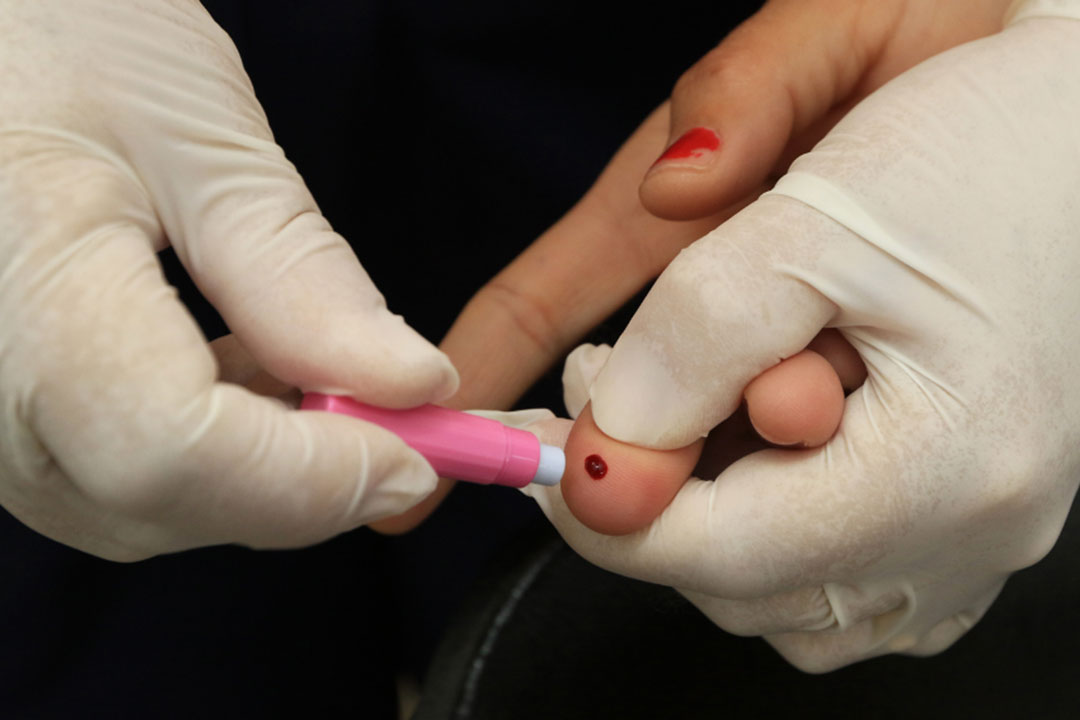 HIV is commonly tested using blood. Kiyohiko Izumi, team leader for sexually transmitted infections in the WHO says climate change can lead to increased vulnerability to HIV. Credit: Sandro Araújo/SES, (CC BY-NC-ND 2.0)