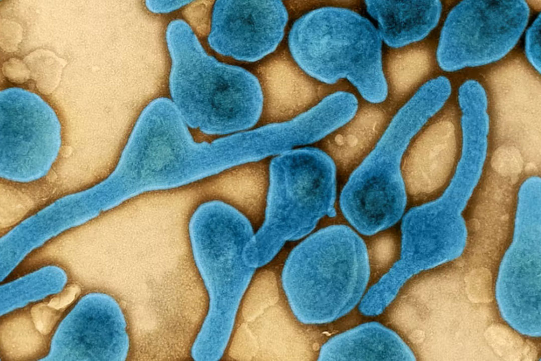 Micrographie électronique à transmission colorisée de particules du virus de Marburg (bleu, fausses couleurs) récoltées dans le surnageant de cellules VERO E6 infectées. NIAID - Integrated Research Facility à Fort Detrick, Maryland, États-Unis.