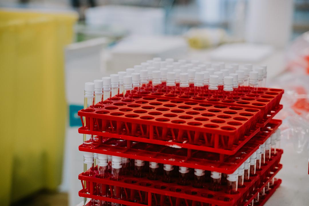 A rack of test tubes in a lab. Credit: Mat Napo on Unsplash