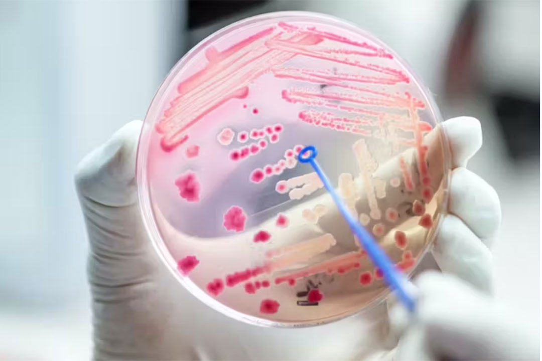 A petri dish with bacteria. Credit: Shutterstock