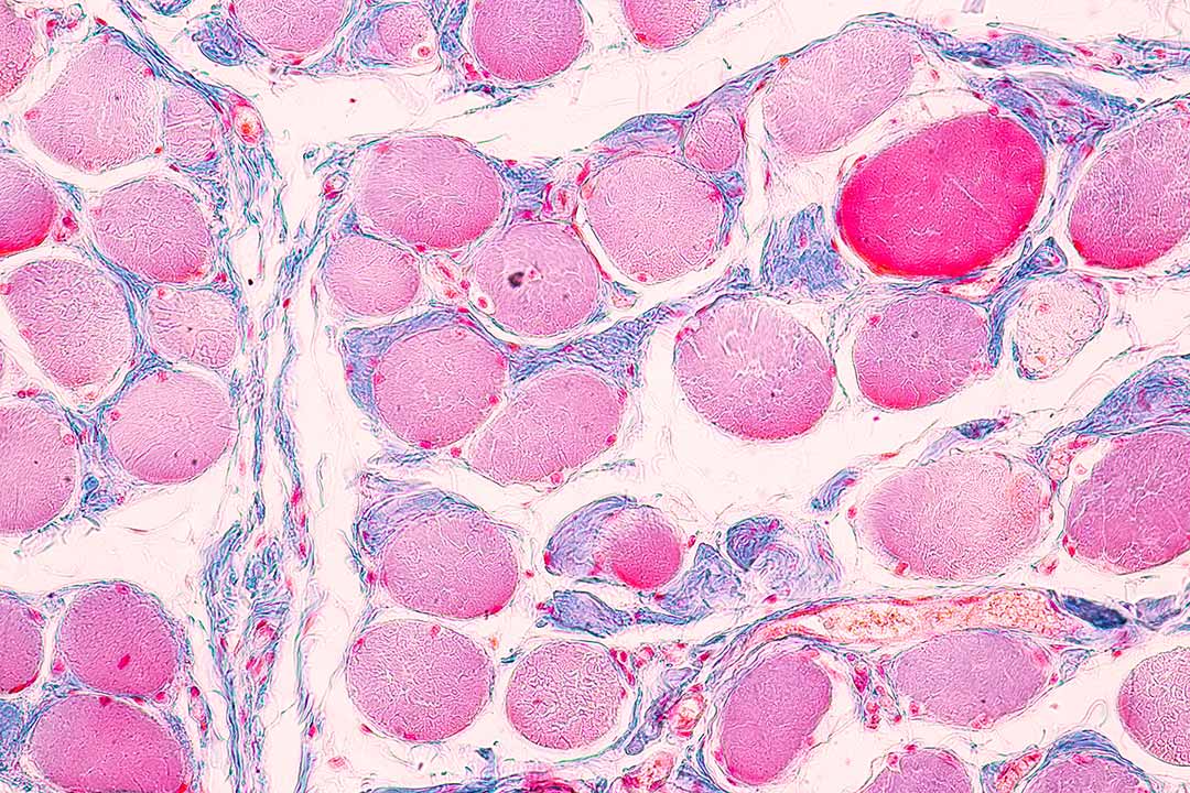 Human cells under the microscope.