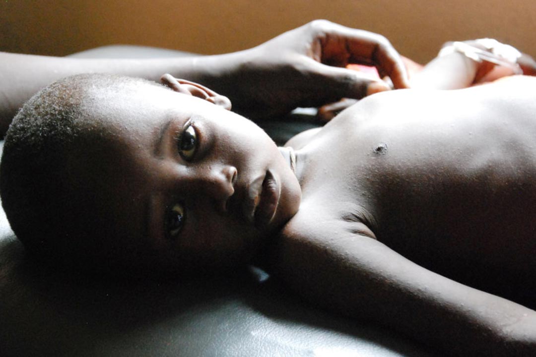 Abdul Kamara of Sierra Leone was threatened by severe diarrhoea, but he received rehydration treatment. Every year, 3 million children and adolescents die from infectious diseases study indicates. Credit: Doune Porter / GAVI, (CC BY-NC-ND 2.0)