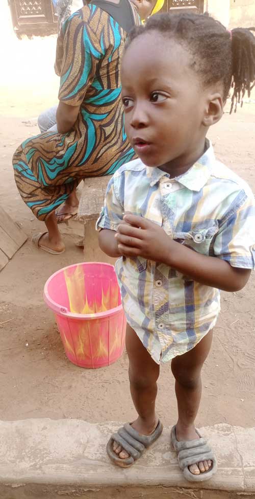 Buba, one of the survivors of the disease in Kano. Credit: Eric Dumo