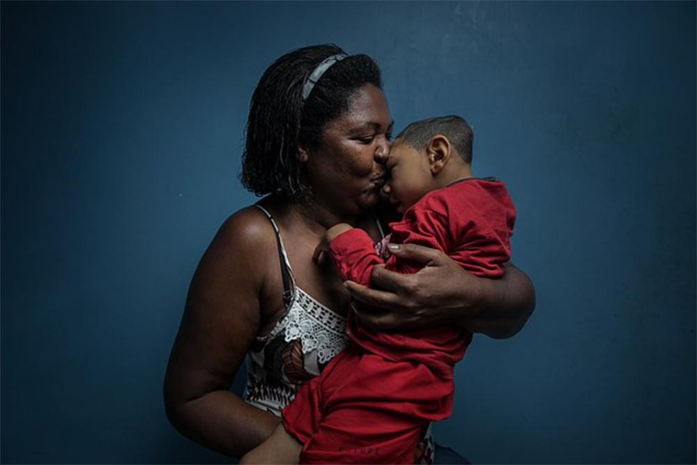 João Gabriel, born with microcephaly caused by a Zika virus infection, with his adoptive mother, Marilene da Silva. Image by Felipe Fittipaldi/Wellcome Photography Prize 2019 via Wikimedia Commons (CC BY 4.0).