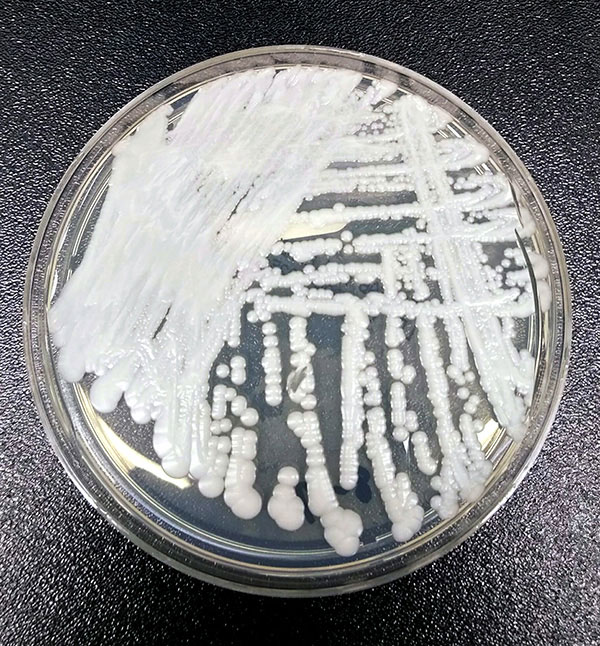 A petri dish streaked with colonies of Candida auris, a fungal pathogen of people. Credit: Shawn Lockhart / CDC
