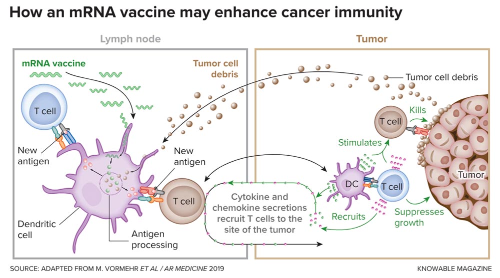 This schematic illustrates how an mRNA vaccine can help the body fight cancer cells. The mRNA carries instructions for making little pieces of protein that are produced by tumor cells. When the mRNA is taken up by dendritic cells of the immune system, the protein pieces (antigens) are produced and displayed on the surface of the dendritic cells. This display trains T cells to respond to the new antigen with an attack against the tumor. In a natural situation, the tumor itself releases bits of cancer debris (shown as little brown blobs) that are taken up by dendritic cells to train T cells. However, the immune system doesn’t react to all kinds of tumor antigens. The mRNA vaccine can train the body to target tumor antigens it normally doesn’t respond to. The result is a more effective attack against cancer cells.