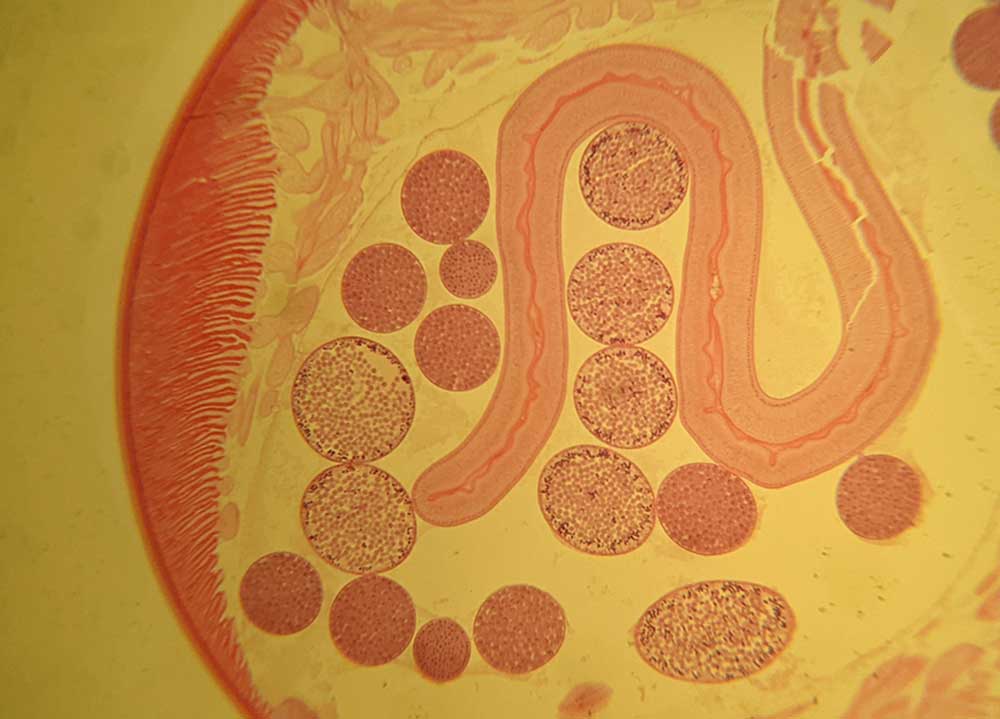 Schistosoma is a genus of trematodes, commonly known as blood flukes. They are parasitic flatworms responsible for a highly significant group of infections in humans termed schistosomiasis