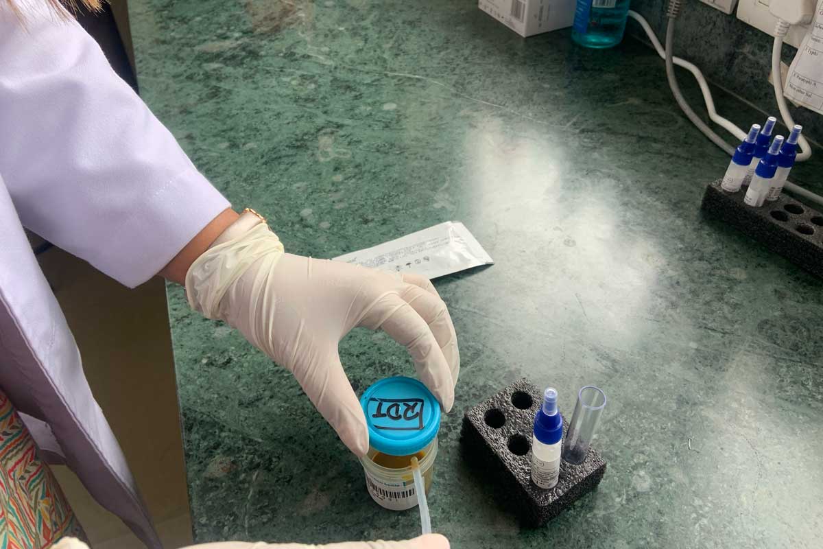 The RDT kit being used to process a stool sample in the infectious disease hospital, Kathmandu. Credit: Pragya Timsina
