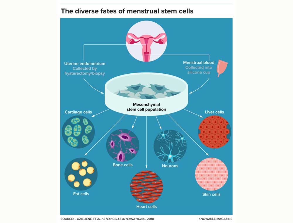 Stem cells from the endometrium can be collected through a biopsy or in menstrual blood. Under the right conditions, they can differentiate into cell types including neurons and cartilage, fat, bone, heart, liver and skin cells.