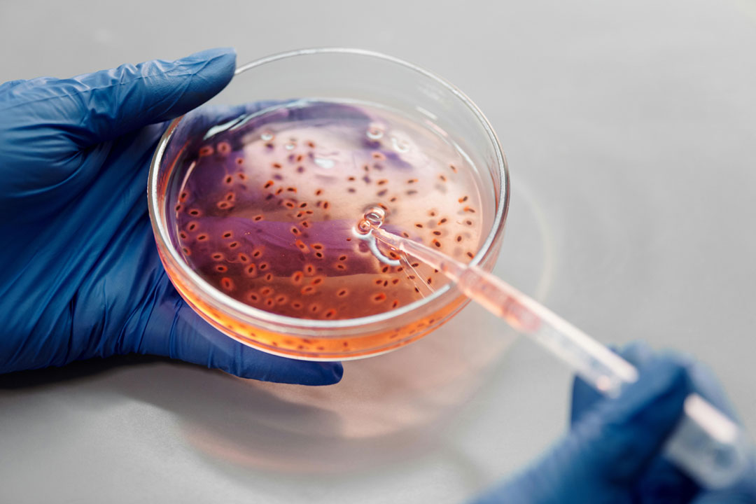 Vaccines can prevent many infections, reducing the need for antibiotics and the risk of developing resistance. Credit: Edward Jenner on Pexels