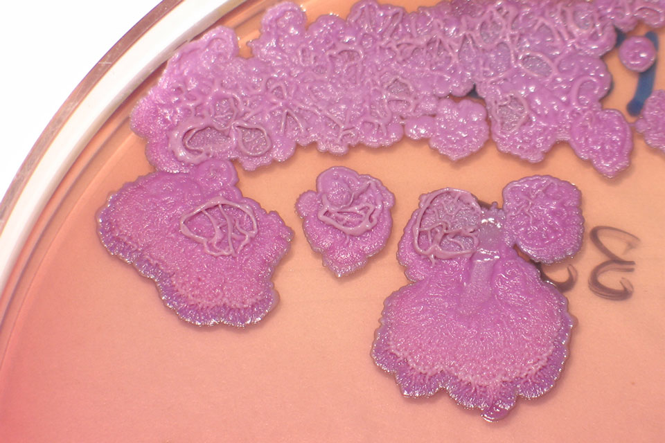 Burkholderia-pseudomallei-growing-on-agar-plates