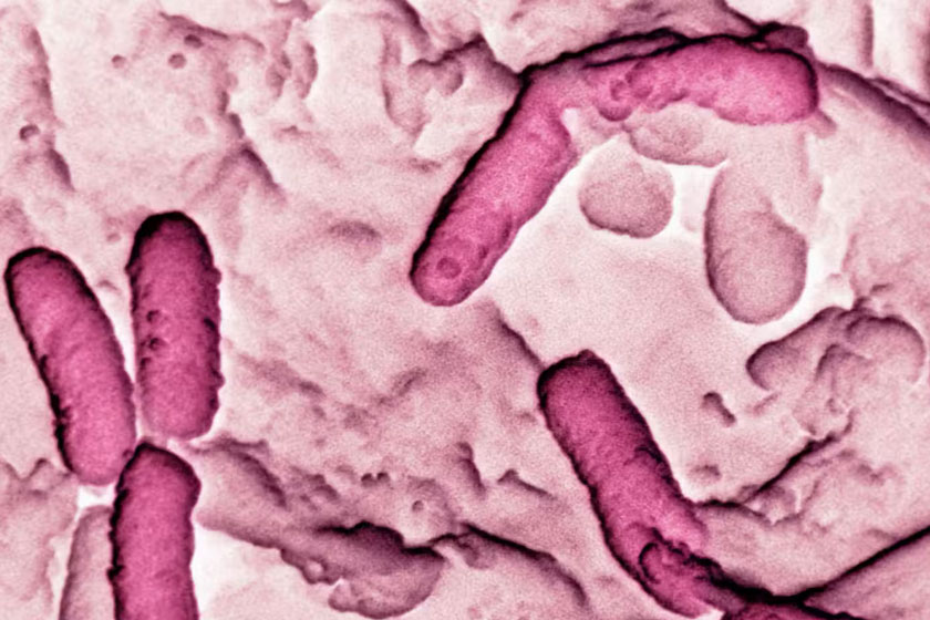 Electron micrograph of Pseudomonas aeruginosa