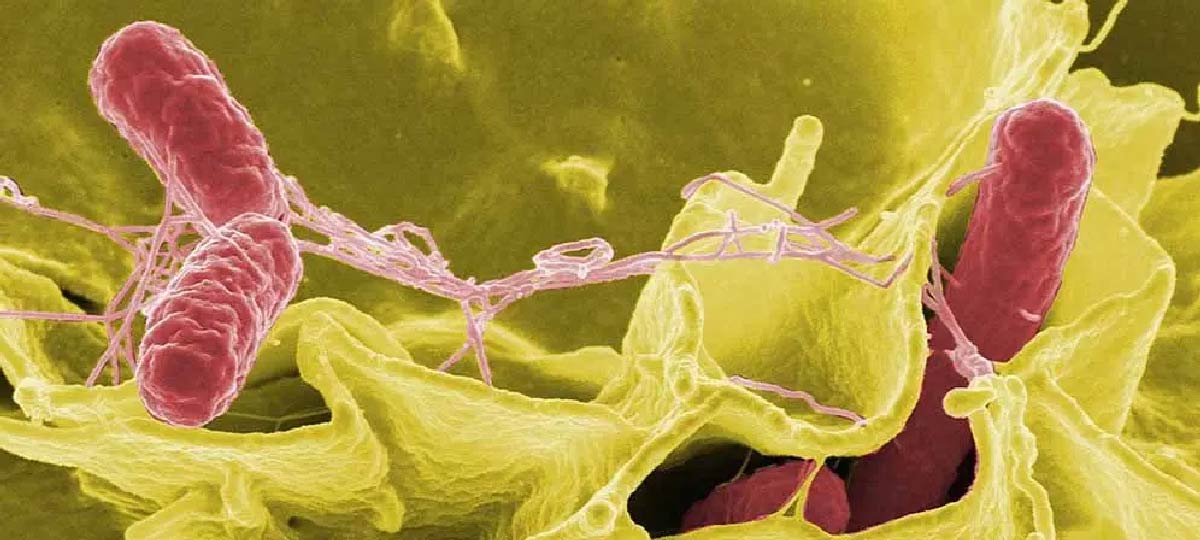 Color-enhanced scanning electron micrograph showing Salmonella Typhimurium (red) invading cultured human cells. In north-eastern Uganda, a study has shown that nearly half the food and water in the region is contaminated with drug-resistant Salmonella. Rocky Mountain Laboratories, NIAID, (Public domain)