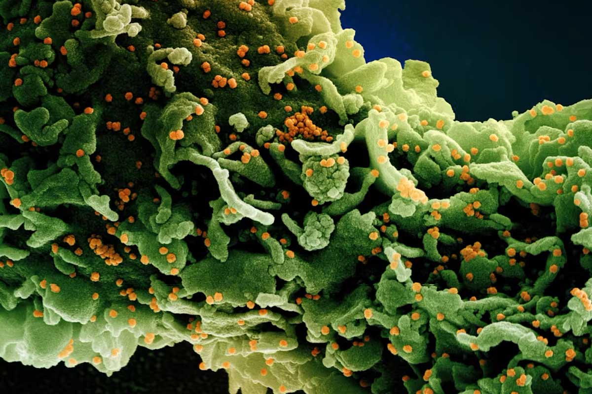 Colourized microscopic image of a cell (green) infected with orange virus particles of a variant strain of SARS-CoV-2 (the UK B.1.1.7 variant), isolated from a patient sample. (NIAID)