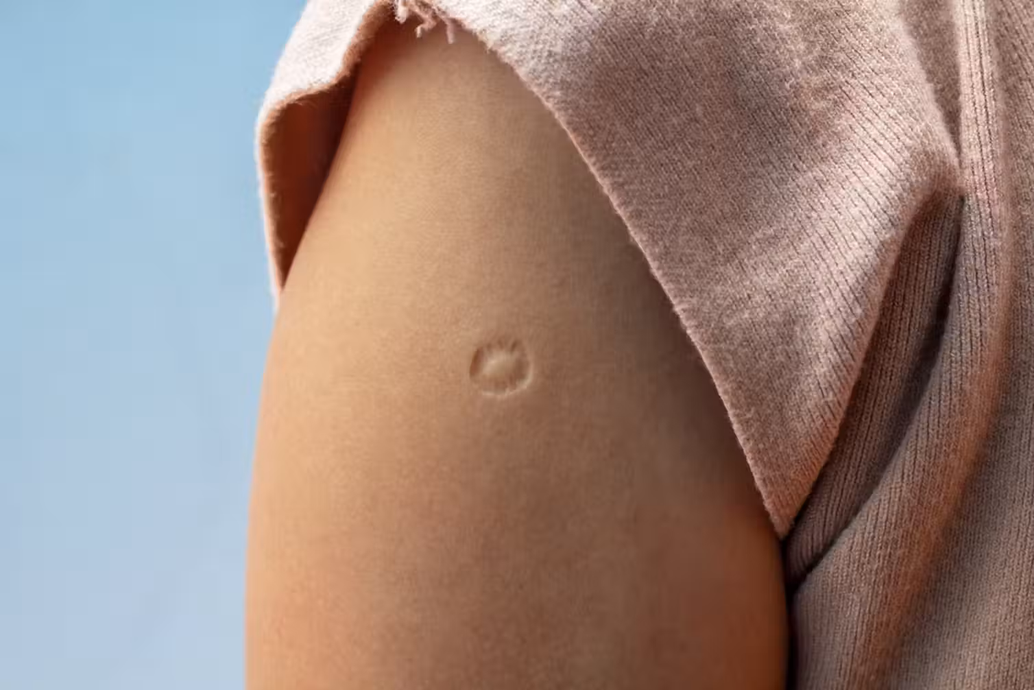BCG is still the only TB vaccine, but it’s not highly effective.  TuktaBaby/Shutterstock
