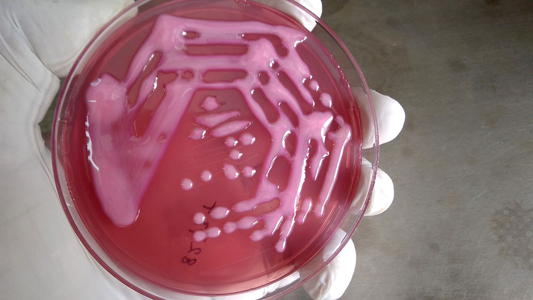 Commonly found among gut flora, the bacterium Klebsiella pneumoniae readily acquires antibiotic resistance genes. Pandrug-resistant strains evoke the fiercest dread in Ukraine — and are ringing alarm bells in western Europe.  CREDIT: AJAY KUMAR CHAURASIYA / WIKIMEDIA COMMONS