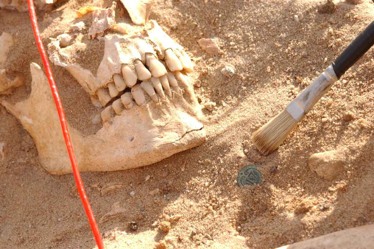 Skull of a soldier from Napoleon's army. Credit: Michel Signoli, Aix-Marseille Université