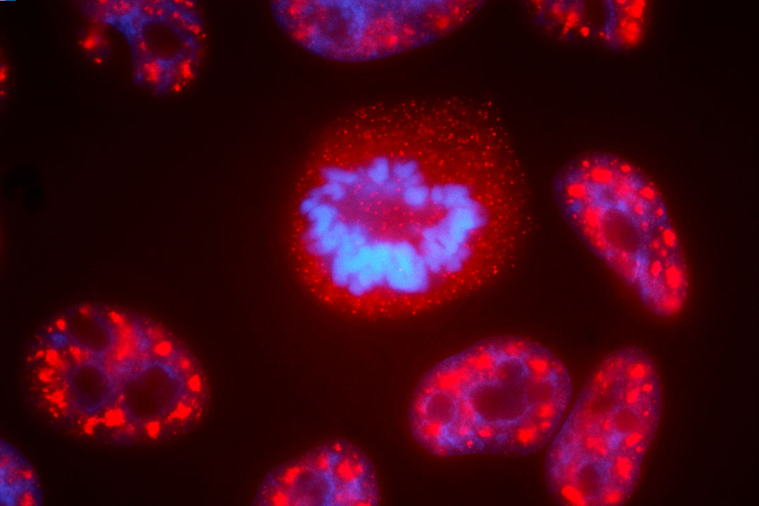 Human cells in which RNA-processing proteins show up as red, and chromosomes show up as blue. These colored speckles disassemble and reassemble during cell division (center cell). Credit: NIH/Flickr