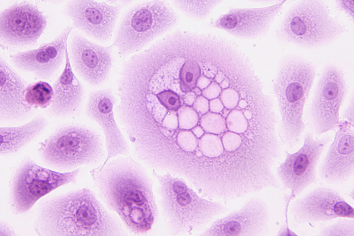 HPV-16 E5 Oncoprotein under the microscope. Credit: National Cancer Institute