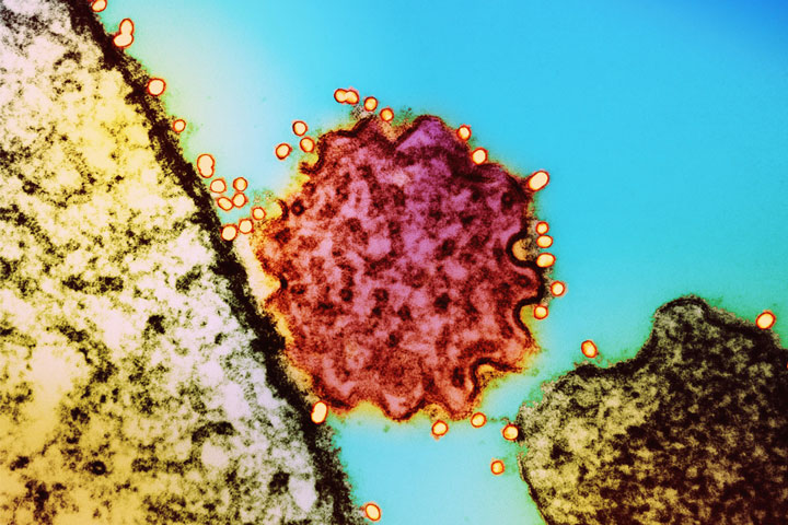 Nipah virus particle. Credit: National Institute of Allergy and Infectious Diseases