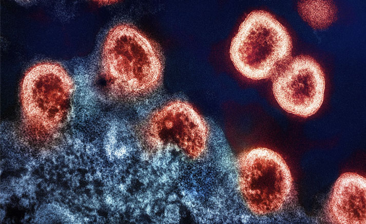 Virus particles. Credit: National Institute of Allergy and Infectious Diseases