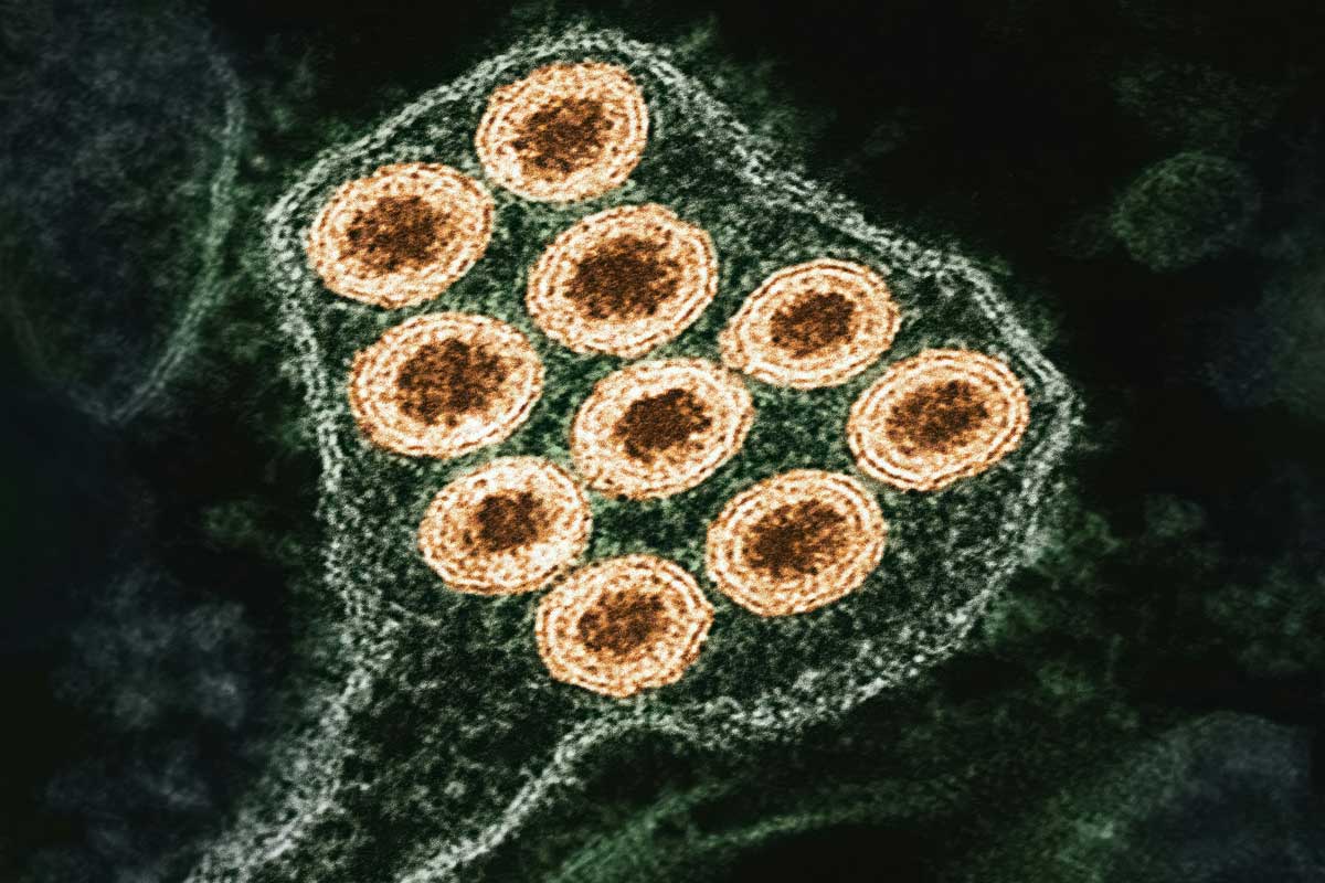 Colorised transmission electron micrograph of rabies virus particles. Credit: NIAID