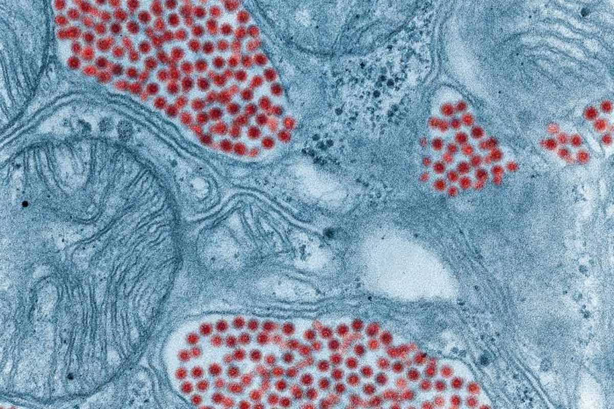 Colourised transmission electron micrograph (TEM) depicting a salivary gland that had been extracted from a mosquito, infected by the Eastern equine encephalitis (EEE) virus. Credit: Fred Murphy and Sylvia Whitfield, CDC Public Library