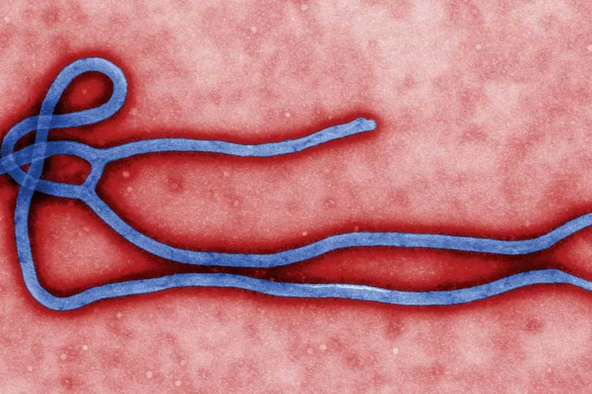 Electron micrograph of an ebolavirus virion. Credit: Cynthia Goldsmith/Center for Disease Control and Prevention