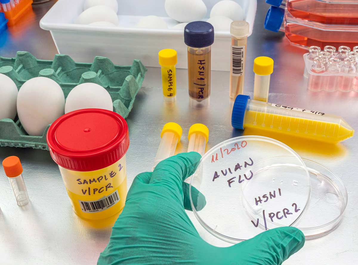 There is currently no bird flu vaccine for people. Digicomphoto/ Science Photo Library via Getty Images
