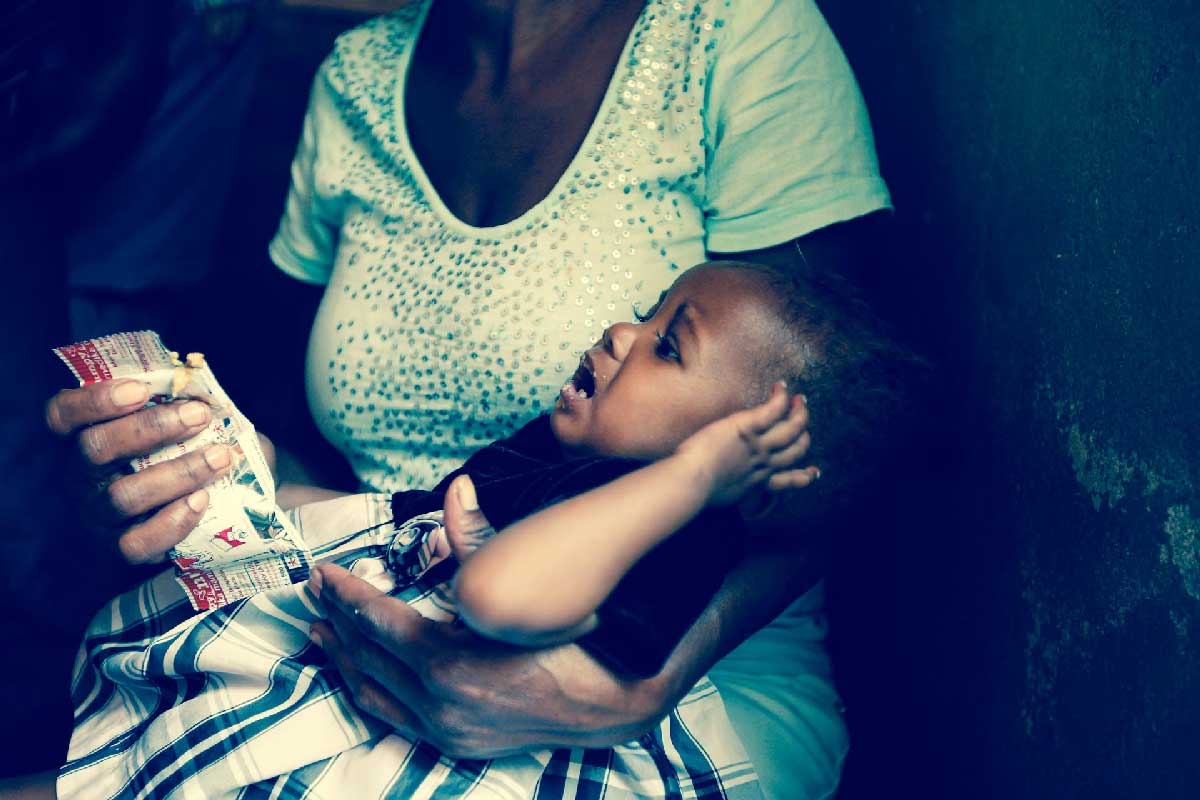 Globally, nearly half of the deaths of children under five years are linked to malnutrition. Wikimedia Commons