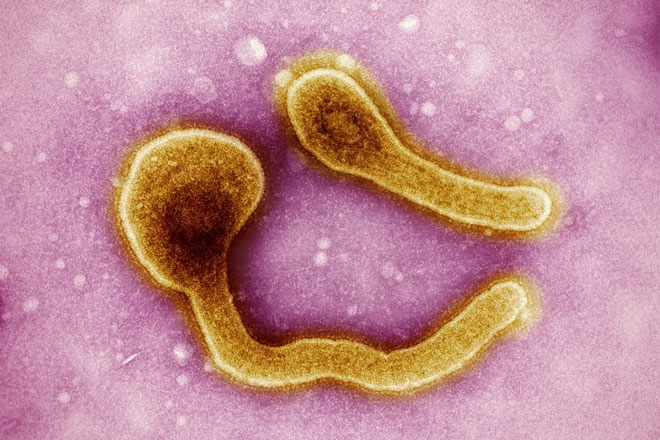 Marburg virus particles colourised. Credit: The National Institute of Allergy and Infectious Diseases (NIAID)