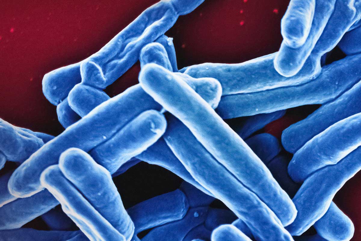Mycobacterium Tuberculosis Bacteria Scanning electron micrograph. Credit: National Institute of Allergy and Infectious Diseases on Unsplash.