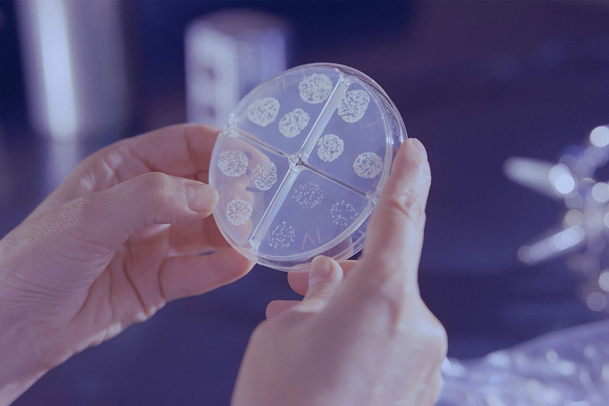 A Mycobacterium tuberculosis drug susceptibility test. Credit: CDC/Unsplash