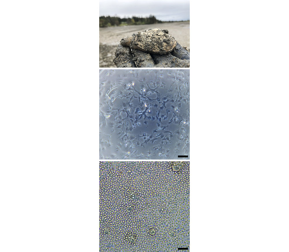Top: Soft-shell clams like this one in Puget Sound, Washington State, are in the middle of a transmissible leukemia epidemic. Middle: The clam leukemia is derived from blood cells called hemocytes. Normal hemocytes shown here stick to microscope slides and stretch into splayed, irregular shapes. Bottom: Cancerous hemocytes lose their splayed shapes, instead forming compact balls. CREDIT: S.A. WEINANDT ET AL / PNAS 2026