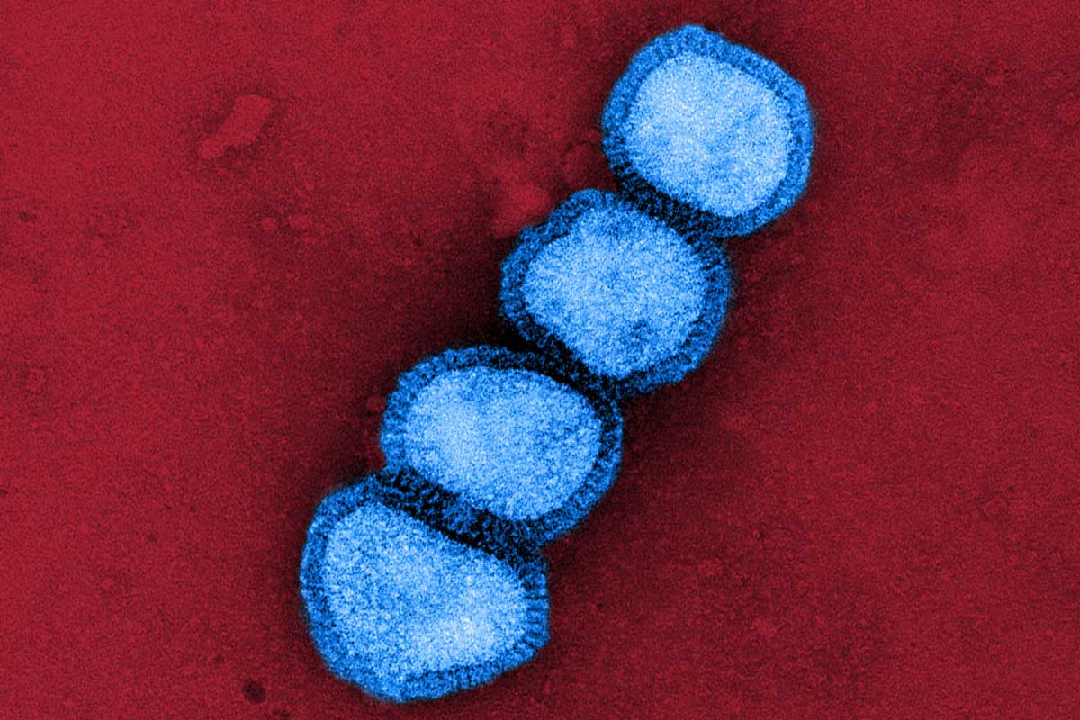 Colorised transmission electron micrograph of influenza A/H1N1 virus particles (blue). Credit: NIAID/NIH