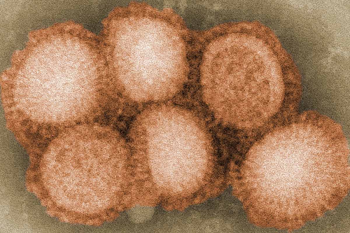 Flu Cells visible under microscope. Credit: Cybercobra at English Wikipedia (CC BY-SA 3.0)