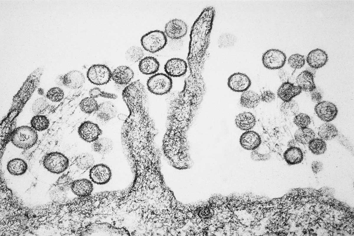 A transmission electron micrograph of Sin Nombre virus. Credit: CDC/Cynthia Goldsmith