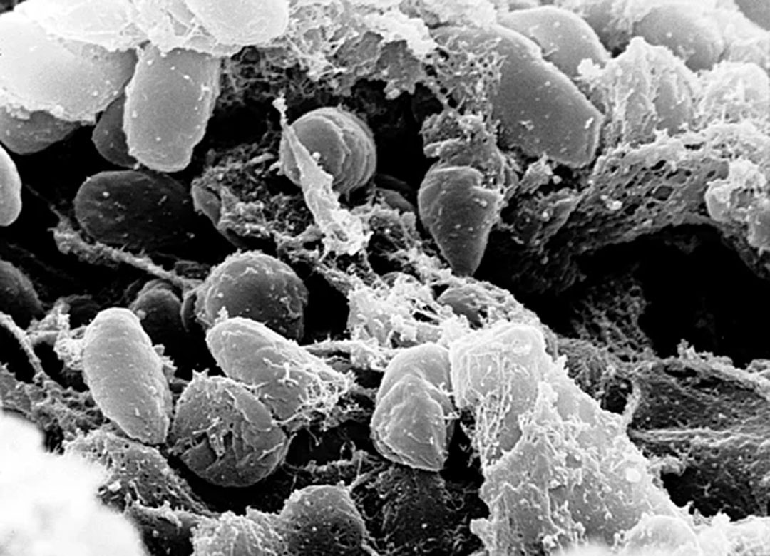 A scanning electron micrograph depicting a mass of Yersinia pestis bacteria
