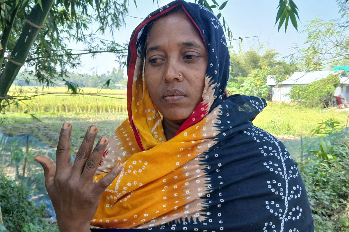 Fatema, a 40 year-old woman in the Rangpur district, showing her infected hands. Credit: Mohammad Al Amin