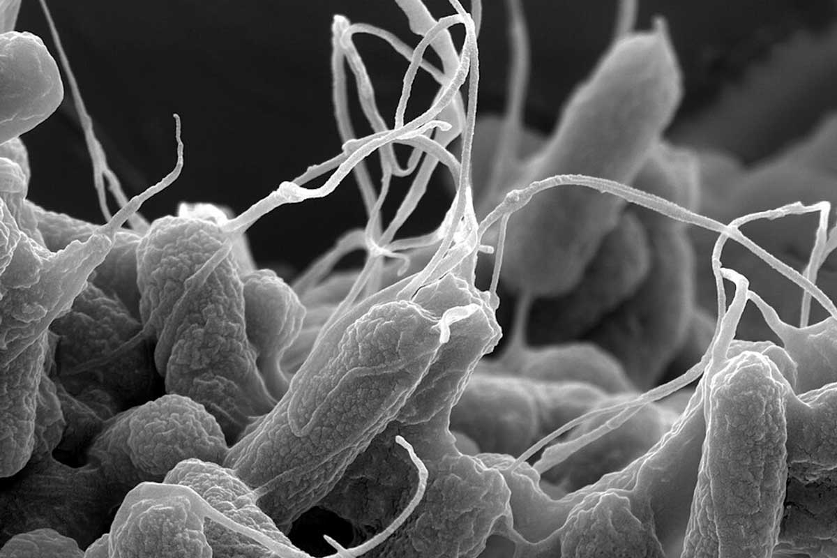 Physics-based simulations can help identify which peptide antibiotics can kill a bacteria like E. coli, pictured here using electron microscopy. (Nurgul D / Wikimedia Commons), CC BY-SA