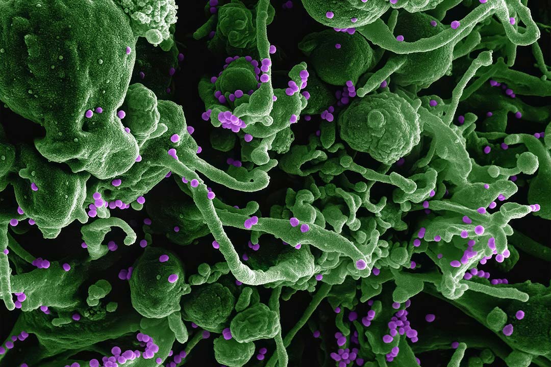 Micrograph of Lassa virus budding off a cell. Photo by National Institute of Allergy and Infectious Diseases on Unsplash